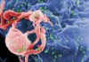 HIV-budding-Color.jpg